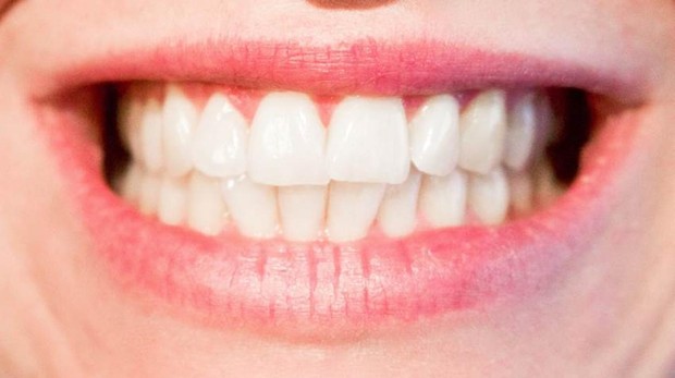 Nanopartículas Para Remineralizar Dientes Y Huesos