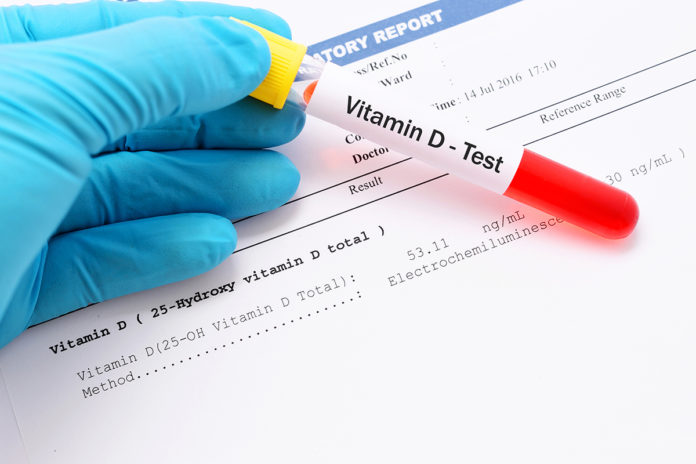 Vitamina D Fibemedic