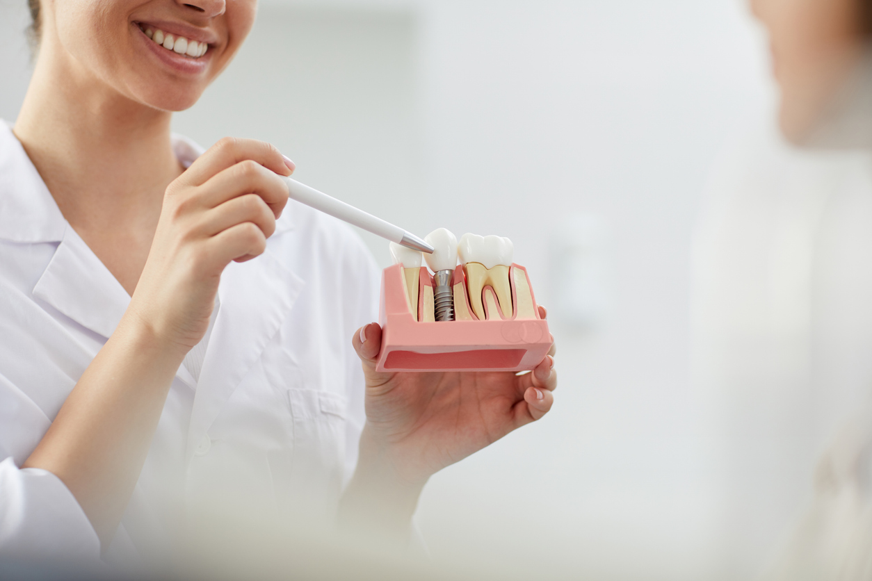 cuidados de implantes dentales