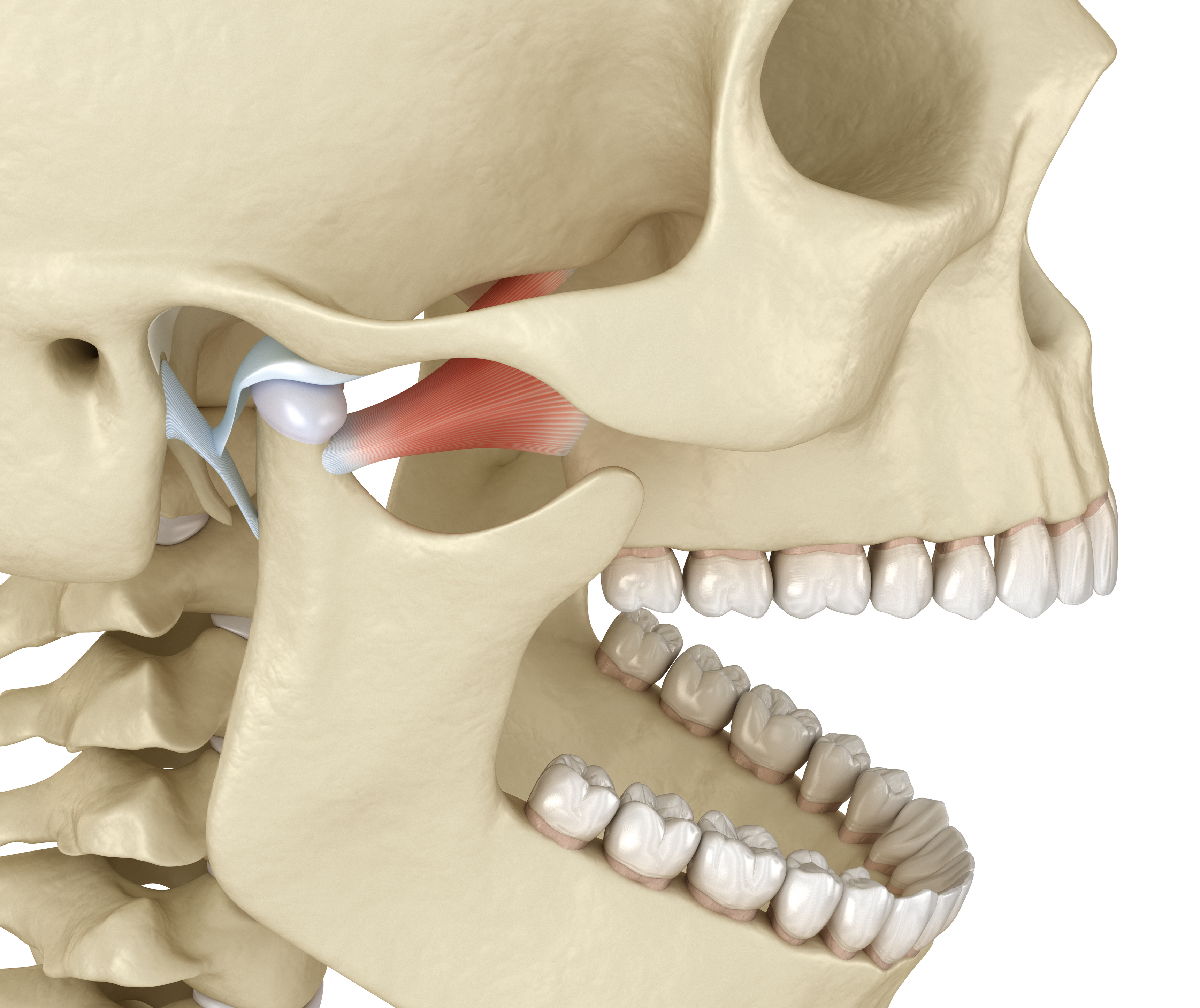 Bloqueo Mandibular