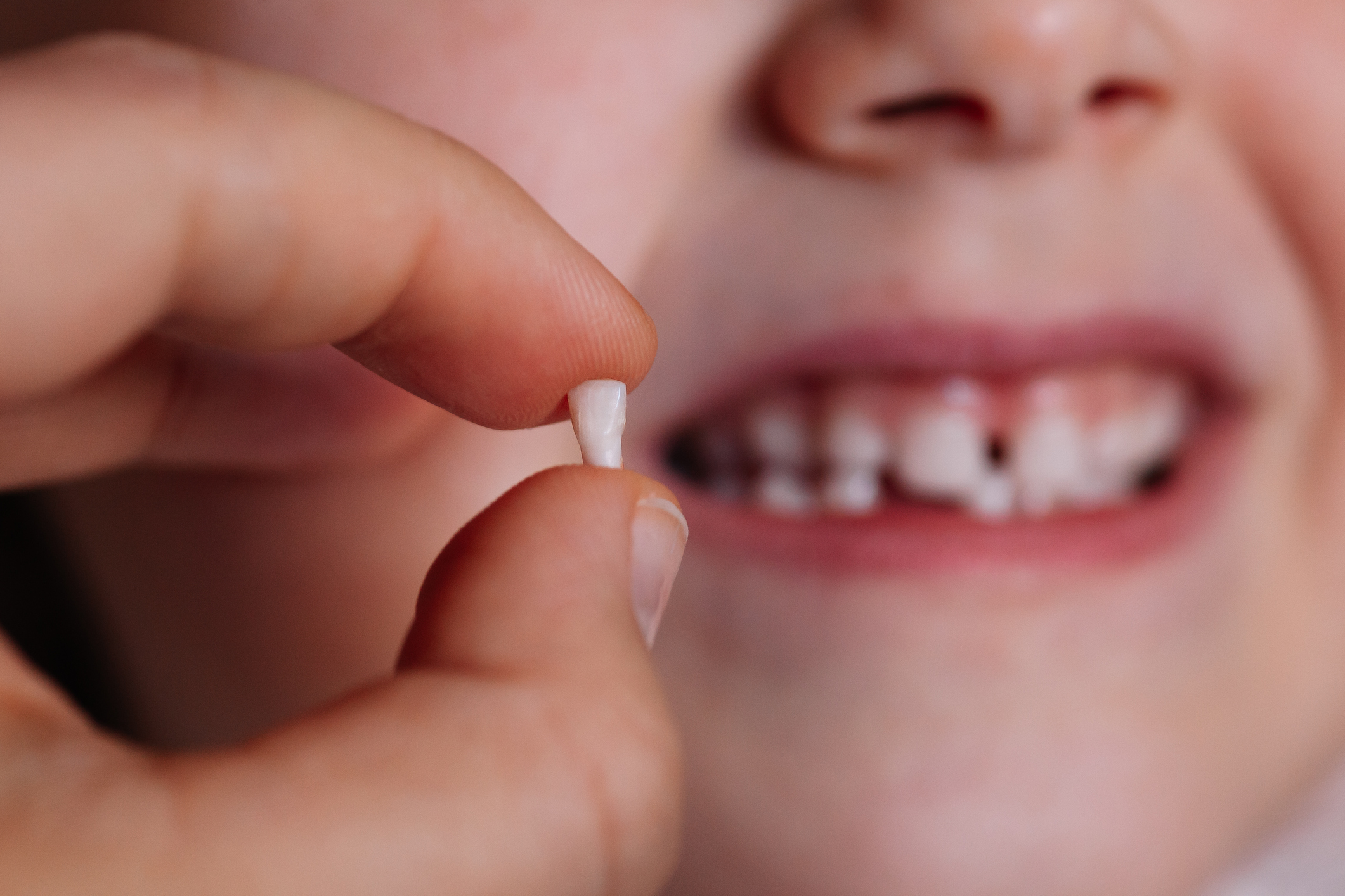 niño pierde dientes de leche