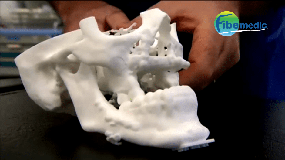 Mandibula 3d