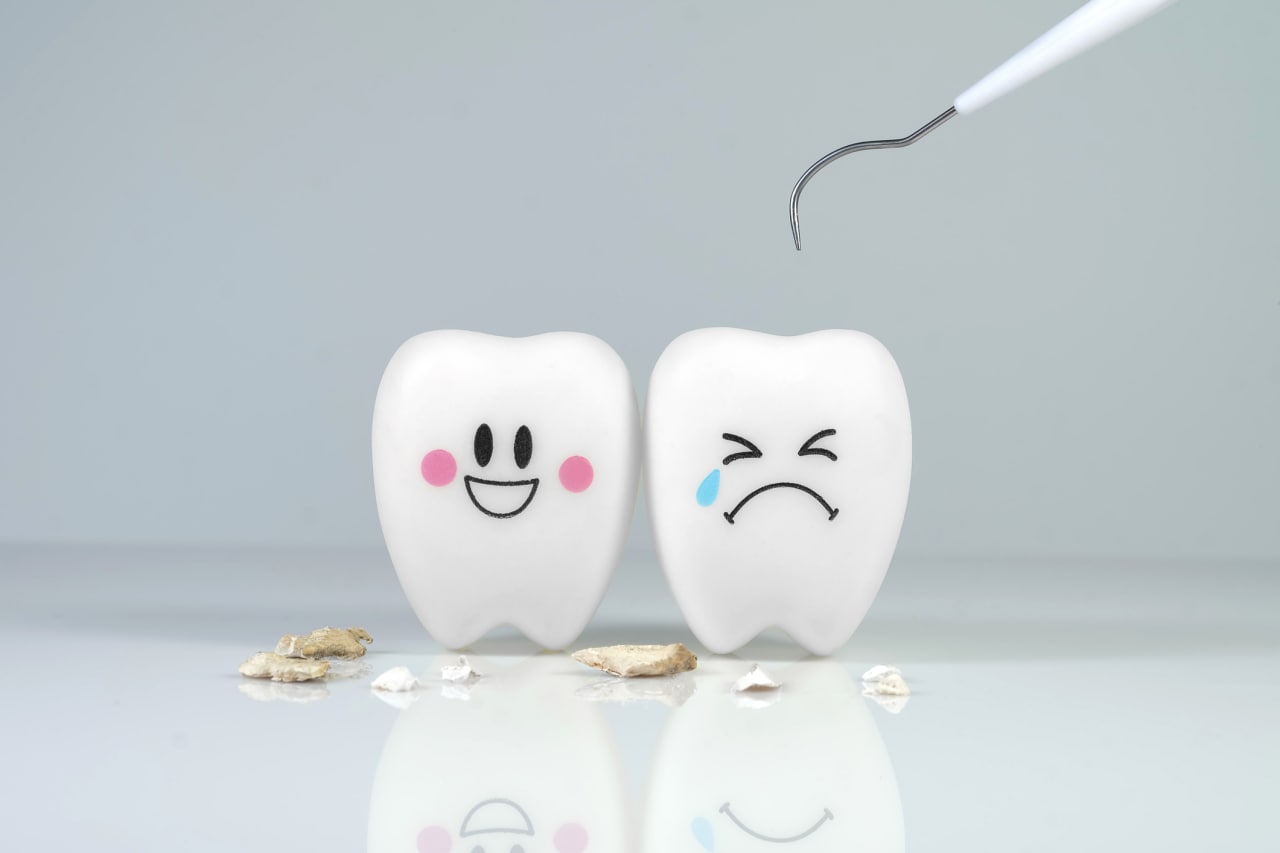 Cómo prevenir el sarro dental