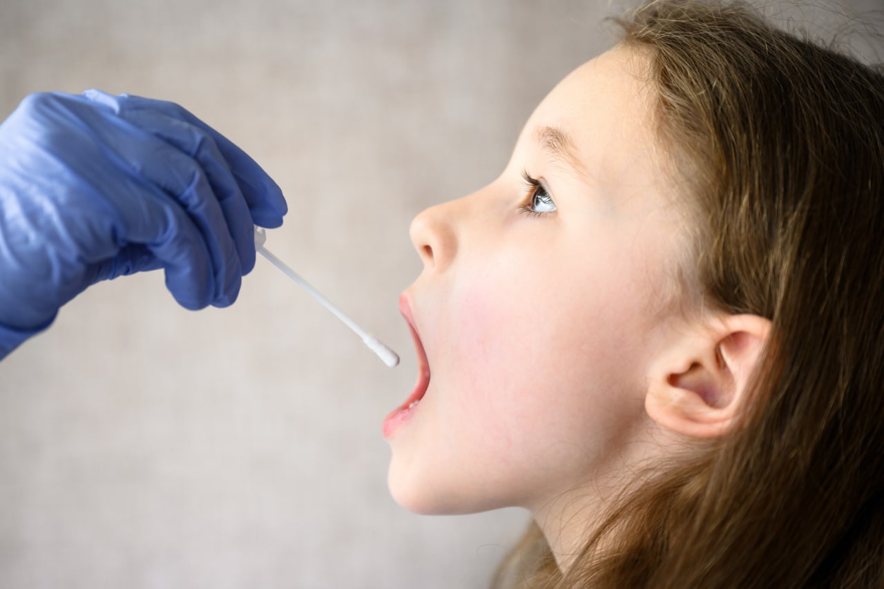 Infecciones orales niños odontopediatra en Sevilla la Nueva